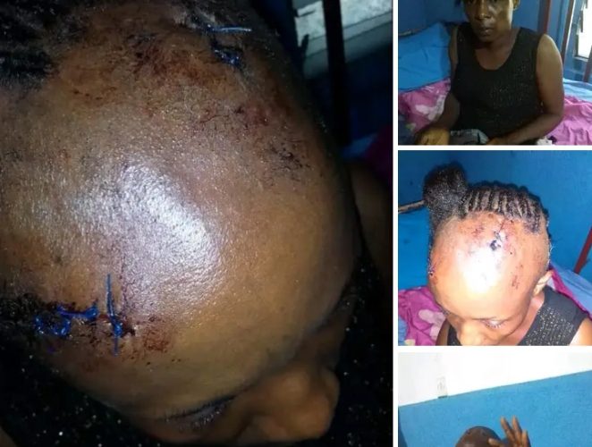 Landlord Attacks Tenant, Wife with Machete in Rivers State