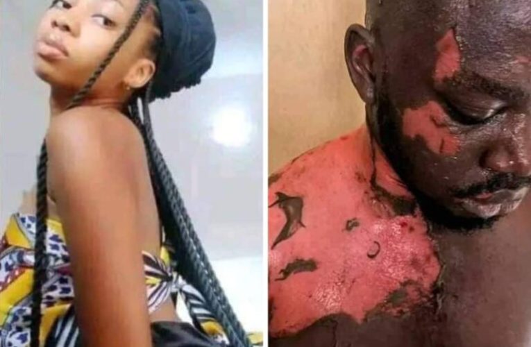 PHOTOS: UNIZIK Female Student Allegedly Stabs, Baths Lodge President with Hot Water