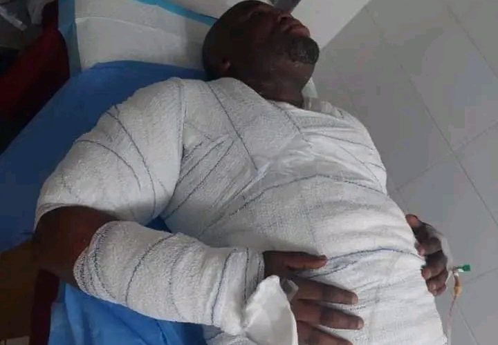 Abia Millionaire Architect Hospitalized, Following Severe Burns Caused by Wife’s Boiling Paste Assault